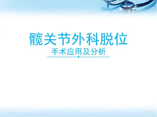 髋关节外科脱位医学PPT课件