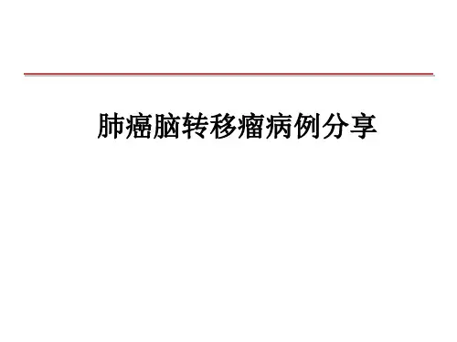 肺癌脑转移瘤病例分享