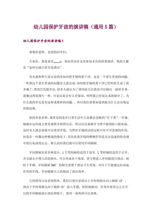 幼儿园保护牙齿的演讲稿(通用5篇)