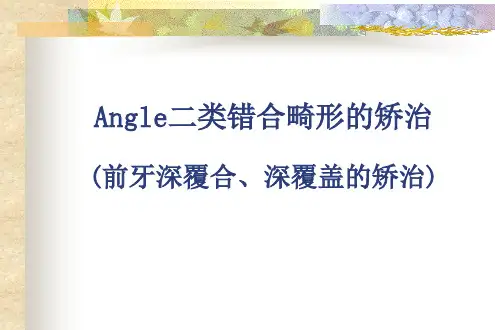 二类错合矫治