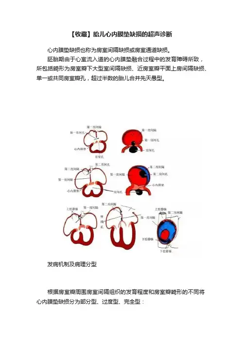【收藏】胎儿心内膜垫缺损的超声诊断