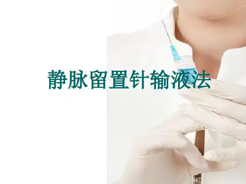 静脉留置针输液法