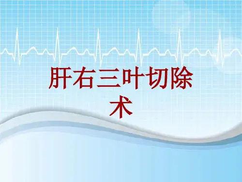 手术讲解模板：肝右三叶切除术