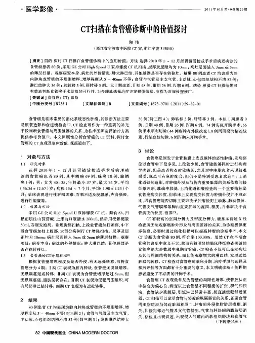 CT扫描在食管癌诊断中的价值探讨