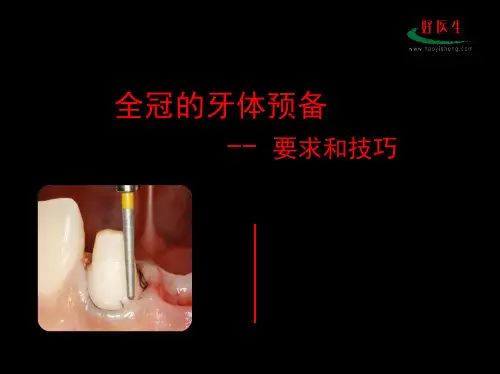 全冠牙体预备