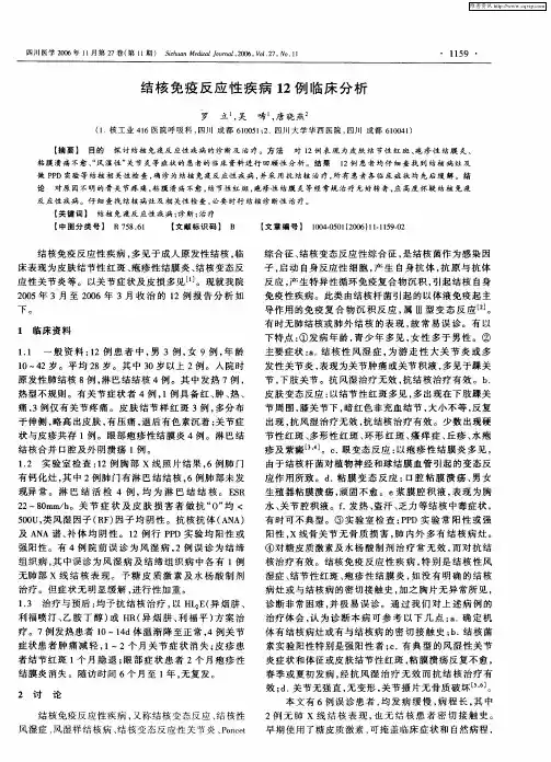 结核免疫反应性疾病12例临床分析