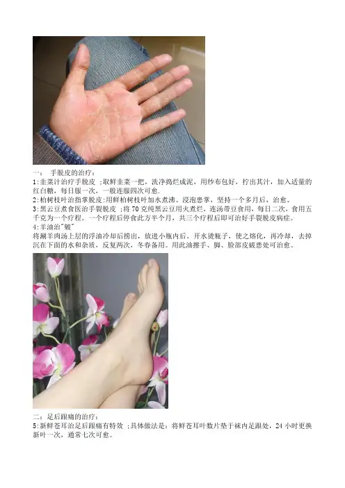 皮肤病生活小偏方