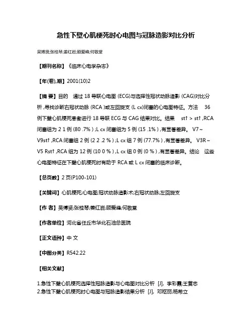 急性下壁心肌梗死时心电图与冠脉造影对比分析