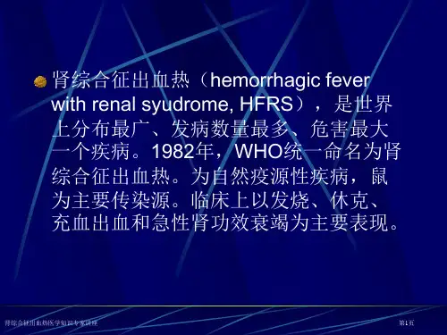 肾综合征出血热医学知识专家讲座