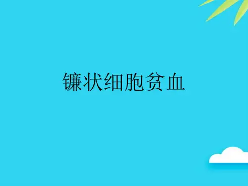 镰状细胞贫血