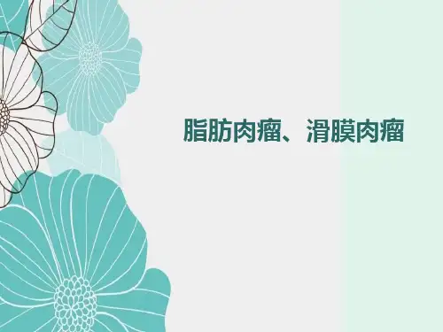 脂肪肉瘤与滑膜肉瘤影像表现