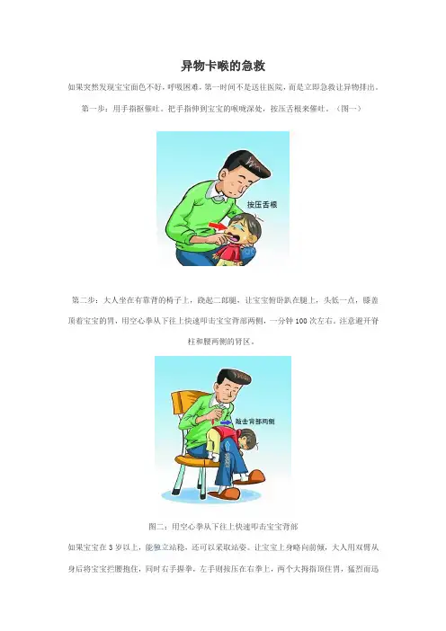 异物卡喉急救——奥本海姆法
