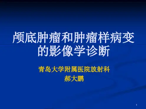 颅底肿瘤和肿瘤样病变的影像学诊断参考幻灯片