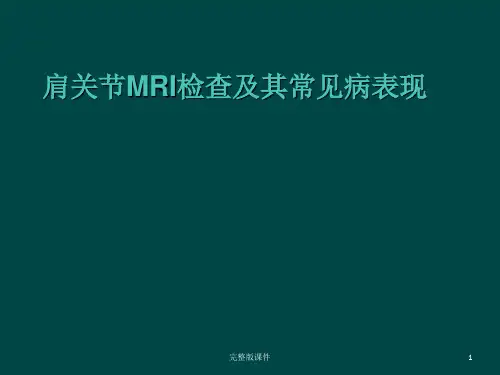 肩关节MRI检查及其常见病表现ppt课件