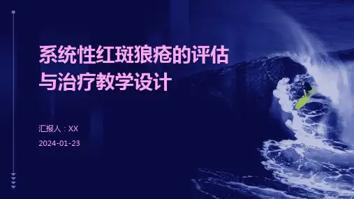 系统性红斑狼疮的评估与治疗教学设计