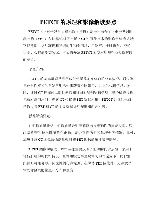PETCT的原理和影像解读要点