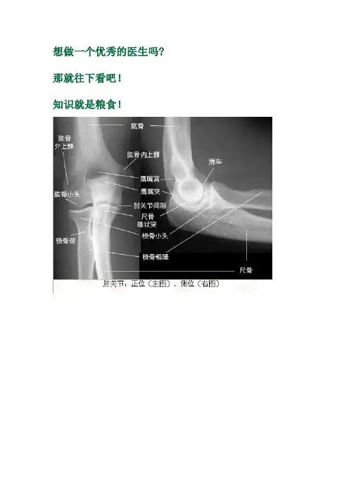X片