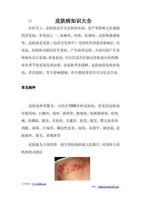 皮肤病知识大全
