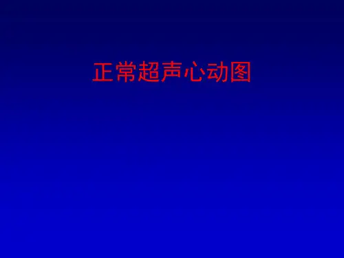 正常超声心动图