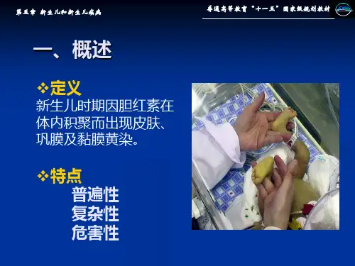 新生儿黄疸PPT课件-精选文档