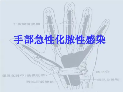 手部的化脓性感染ppt课件