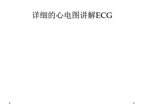 详细的心电图讲解ECG