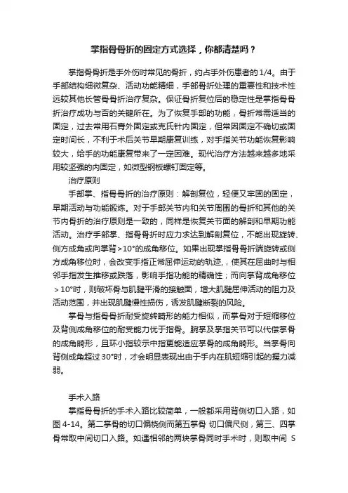 掌指骨骨折的固定方式选择，你都清楚吗？