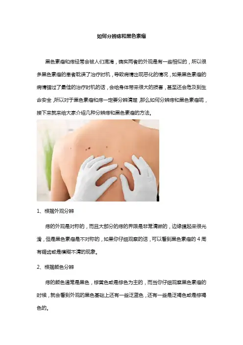 如何分辨痣和黑色素瘤