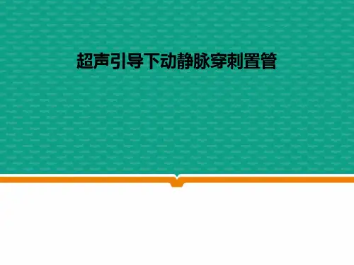 超声引导下动静脉穿刺置管  ppt课件