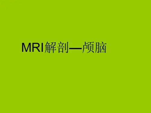 颅脑MRI解剖PPT课件