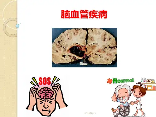 脑血管疾病PPT课件
