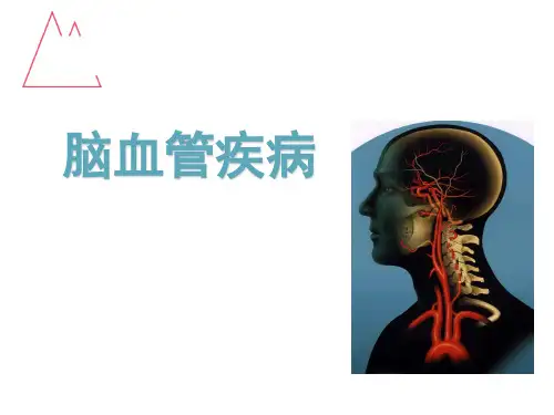 脑血管疾病-课件精选全文完整版