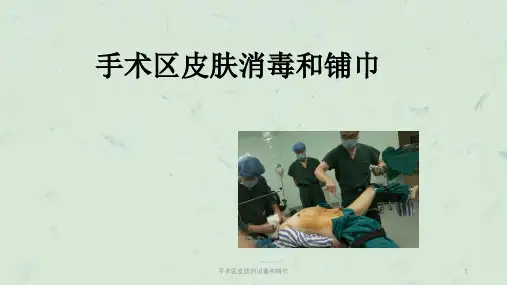 手术区皮肤的消毒和铺巾课件