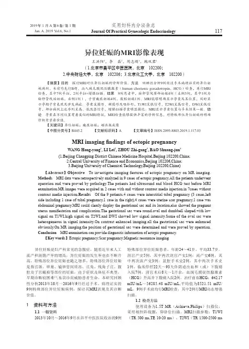 异位妊娠的MRI影像表现