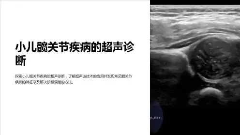 小儿髋关节疾病的超声诊断