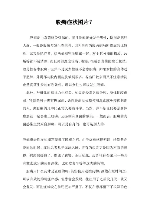 股癣症状图片？