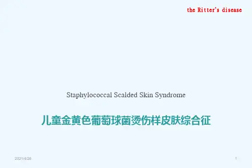 儿童金黄色葡萄球菌烫伤样皮肤综合征