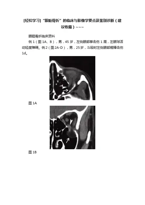 [轻松学习]“眼眶骨折”的临床与影像学要点及鉴别诊断（建议收藏）~~~