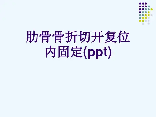肋骨骨折切开复位内固定(ppt)