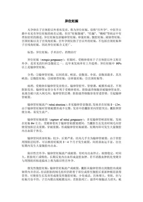 异位妊娠
