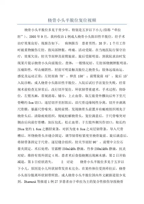 桡骨小头半脱位复位视频