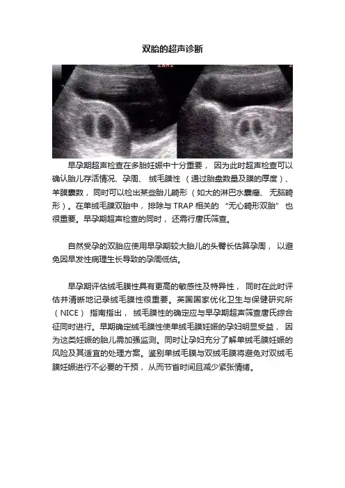 双胎的超声诊断