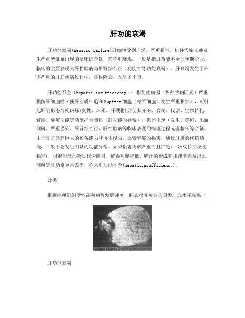 肝功能衰竭