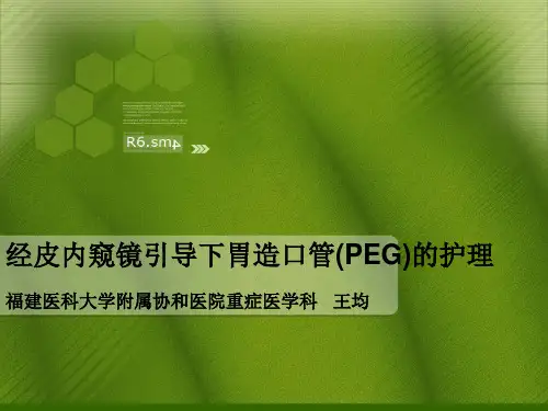 PEG经皮胃造瘘术的护理