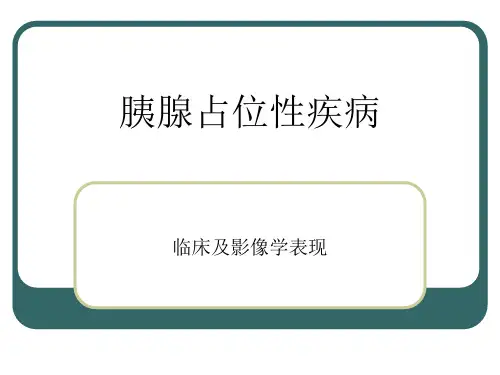 胰腺占位性疾病影像学表现