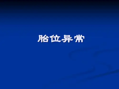 胎位异常-PPT课件