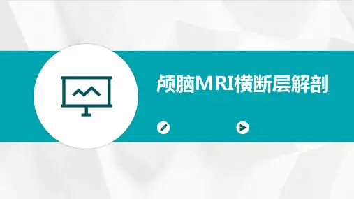 颅脑MRI横断层解剖