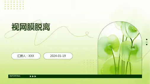 视网膜脱离演示ppt课件
