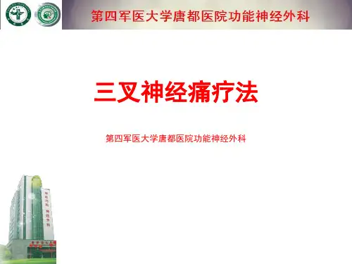 三叉神经痛疗法