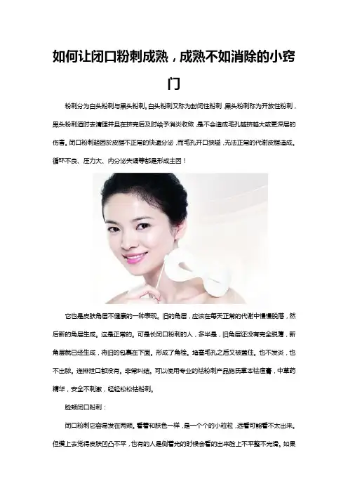 如何让闭口粉刺成熟,成熟不如消除的小窍门